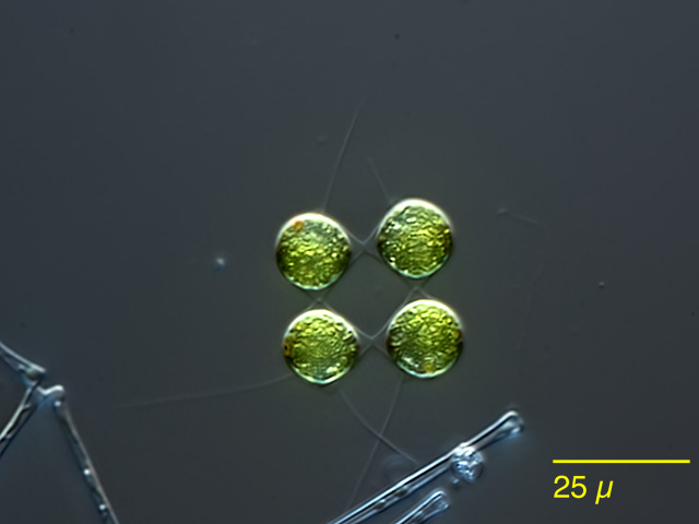Leben im Teich die MosaikGrünalge Gonium sociale) / Tetrabaena socialis